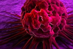 Treatment of Chronic Lymphocytic Leukemia